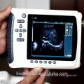 Portable/Palm Handheld Ultrasonic/Ultrasound Machine Price/Medical Equipment